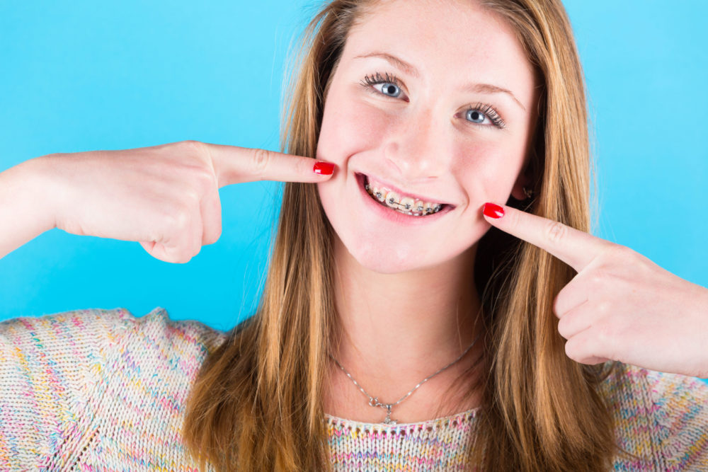 Learn the top 10 things you should know before you get braces from the best orthodontist in Orlando and Ocoee FL